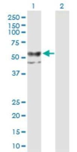 CHST12 Antibody, Novus Biologicals 0.05 mg; Unconjugated:Antibodies, Polyclonal