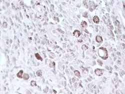 CHX10 Sheep anti-Human, Mouse, Rat, Chicken, Polyclonal, Novus Biologicals:Antibodies:Primary