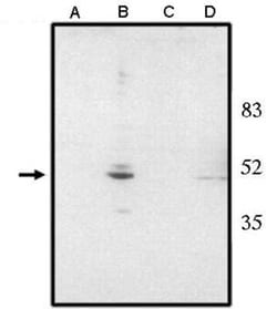 CHX10 Sheep anti-Human, Mouse, Rat, Chicken, Polyclonal, Novus Biologicals:Antibodies:Primary
