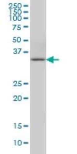 CIAPIN1 Antibody (5G8), Novus Biologicals 0.1 mg | Buy Online | Novus Biologicals | Fisher Scientific