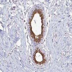 CIB1 Antibody, Novus Biologicals:Anticuerpos:Anticuerpos primarios