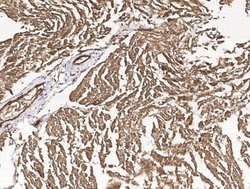 CIB2 Rabbit anti-Human, Clone: 1, Novus Biologicals:Antibodies:Primary