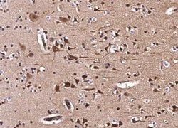 CIB2 Rabbit anti-Human, Clone: 1, Novus Biologicals:Antibodies:Primary