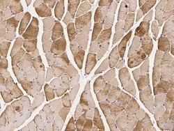 CIB2 Antibody, Novus Biologicals 100 &mu;g | Buy Online | Novus Biologicals | Fisher Scientific