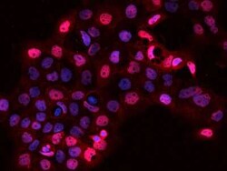 CIP29 Antibody, Novus Biologicals 100 &mu;g, Unconjugated:Anticuerpos