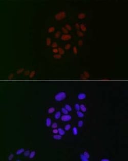 CIRBP Rabbit anti-Human, Mouse, Rat, Clone: 3V9S7, Novus Biologicals 20