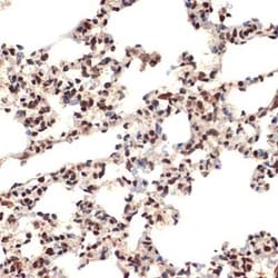 CIRBP Rabbit anti-Human, Mouse, Rat, Clone: 3V9S7, Novus Biologicals 20
