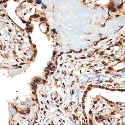 CIRBP Rabbit anti-Human, Mouse, Rat, Clone: 3V9S7, Novus Biologicals 20