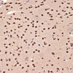 CIRBP Rabbit anti-Human, Mouse, Rat, Clone: 3V9S7, Novus Biologicals 20