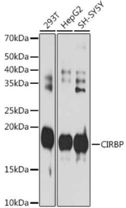CIRBP Rabbit anti-Human, Mouse, Rat, Clone: 3V9S7, Novus Biologicals 20
