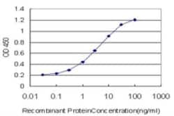 CITED1 Antibody (5H6), Novus Biologicals 0.1 mg, Unconjugated:Antibodies,