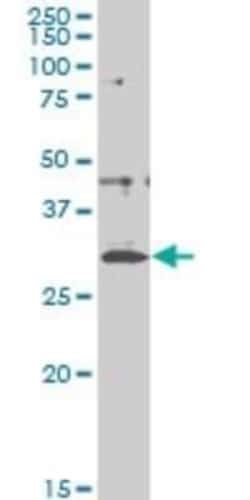 CITED1 Antibody (5H6), Novus Biologicals 0.1 mg, Unconjugated:Antibodies,