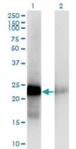 CITED1 Antibody (5H6), Novus Biologicals 0.1 mg, Unconjugated:Antibodies,
