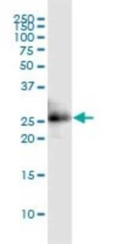 CITED1 Antibody (6C1), Novus Biologicals 0.1 mg | Buy Online | Novus Biologicals | Fisher Scientific