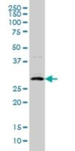 CITED1 Antibody (6G8), Novus Biologicals 0.1 mg | Buy Online | Novus Biologicals | Fisher Scientific