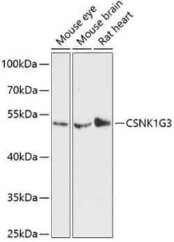 CKI gamma 3 Antibody - Azide and BSA Free, Novus Biologicals:Antibodies:Primary