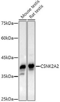 CKII alpha prime polypeptide Rabbit anti-Human, Mouse, Rat, Clone: 3W5P4, Novus Biologicals 100 &mu;g | Buy Online | Novus Biologicals | Fisher Scientific