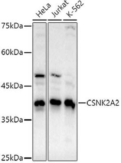 CKII alpha prime polypeptide Rabbit anti-Human, Mouse, Rat, Clone: 3W5P4, Novus Biologicals 100 &mu;g | Buy Online | Novus Biologicals | Fisher Scientific