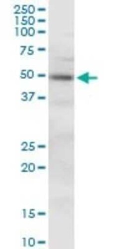CKIP-1 Antibody, Novus Biologicals 0.05 mg | Buy Online | Novus Biologicals | Fisher Scientific