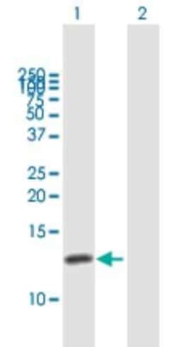 Novus Biologicals CKS1 Antibody, Novus Biologicals 0.05 mg | Buy Online | Novus Biologicals&trade; | Fisher Scientific