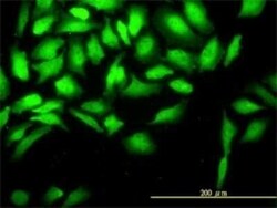 CKS2 Antibody (2H5-2C4), Novus Biologicals 0.1 mg | Buy Online | Novus Biologicals | Fisher Scientific