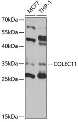 CL-K1/COLEC11 Antibody - Azide and BSA Free, Novus Biologicals 0.1 mL,