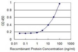 CLP1/HEAB Antibody (8D5), Novus Biologicals 0.1 mg | Buy Online | Novus Biologicals | Fisher Scientific
