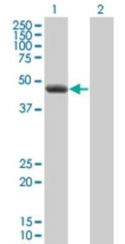 CLP1/HEAB Antibody (8D5), Novus Biologicals 0.1 mg | Buy Online | Novus Biologicals | Fisher Scientific