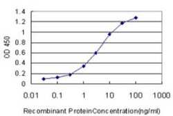 Novus Biologicals CLASP1 Antibody (6A11), Novus Biologicals 0.1 mg | Buy Online | Novus Biologicals&trade; | Fisher Scientific