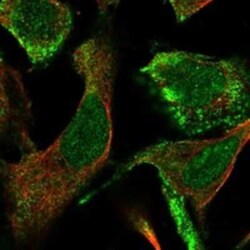 CLCA4 Rabbit anti-Human, Polyclonal, Novus Biologicals 25 &mu;g; Unconjugated:Antibodies,