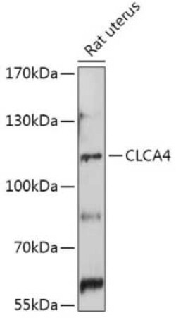 CLCA4 Antibody - Azide and BSA Free, Novus Biologicals 0.02 mL, Unconjugated:Antibodies,