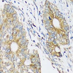 CLCC1 Antibody - Azide and BSA Free, Novus Biologicals:Antibodies:Primary
