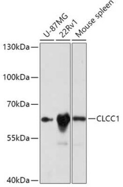 CLCC1 Antibody - Azide and BSA Free, Novus Biologicals:Antibodies:Primary