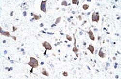CLCN3 Antibody, Novus Biologicals 100 &mu;L; Unconjugated:Antibodies, Polyclonal