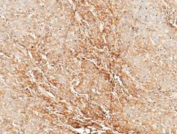 CLEC3B/Tetranectin Rabbit anti-Human, Clone: 6, Novus Biologicals:Antibodies:Primary
