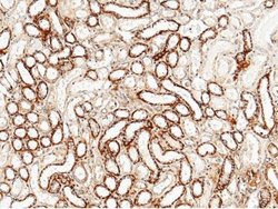 CLEC3B/Tetranectin Rabbit anti-Human, Clone: 6, Novus Biologicals:Antibodies:Primary