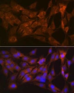 CLEC3B/Tetranectin Rabbit anti-Human, Mouse, Rat, Clone: 3E5Y7, Novus Biologicals 20 &mu;g | Buy Online | Novus Biologicals | Fisher Scientific