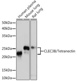 CLEC3B/Tetranectin Rabbit anti-Human, Mouse, Rat, Clone: 3E5Y7, Novus Biologicals 20 &mu;g | Buy Online | Novus Biologicals | Fisher Scientific
