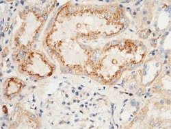 CLEC3B/Tetranectin Antibody, Novus Biologicals 50 &mu;g; Unconjugated:Anticuerpos