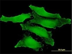 CLIC1 Antibody (2D4), Novus Biologicals 0.1 mg | Buy Online | Novus Biologicals | Fisher Scientific