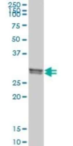 Novus Biologicals CLIC1 Antibody (3F9), Novus Biologicals 0.1 mg | Buy Online | Novus Biologicals&trade; | Fisher Scientific