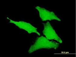 CLIC1 Antibody, Novus Biologicals 50 &mu;g | Buy Online | Novus Biologicals | Fisher Scientific