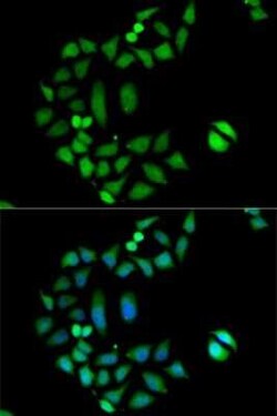 CLIC1 Antibody - BSA Free, Novus Biologicals 0.02 mL, Unconjugated:Antibodies,