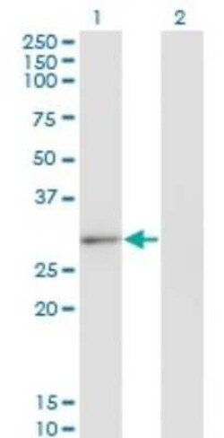 CLIC2 Antibody (2C1), Novus Biologicals 0.1 mg | Buy Online | Novus Biologicals | Fisher Scientific