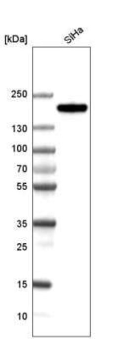 CLIP170 Antibody (CL4844), Novus Biologicals:Antibodies:Primary Antibodies