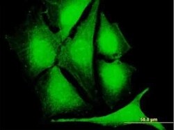 CLK1 Antibody, Novus Biologicals 0.05 mg | Buy Online | Novus Biologicals | Fisher Scientific