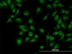 CLK3 Antibody (5B2), Novus Biologicals 0.1 mg | Buy Online | Novus Biologicals | Fisher Scientific