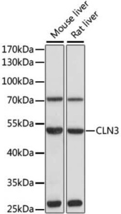 CLN3 Antibody - Azide and BSA Free, Novus Biologicals:Antibodies:Primary