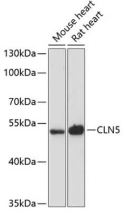 CLN5 Antibody - Azide and BSA Free, Novus Biologicals:Antibodies:Primary