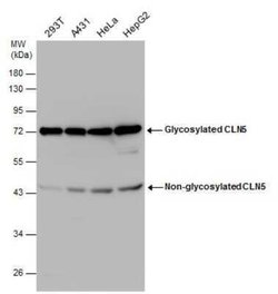 CLN5 Antibody, Novus Biologicals 100 &mu;g | Buy Online | Novus Biologicals | Fisher Scientific